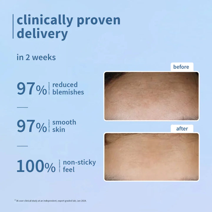 Plum - 10% Niacinamide Serum for Face with Rice Water 15ml