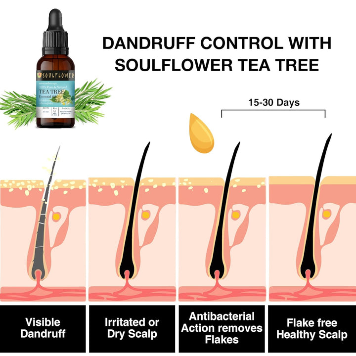 SoulFlower - Tea Tree Essential Oil for Dandruff & Acne 30ml