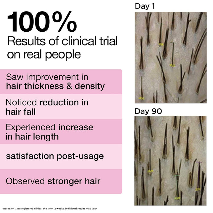 SoulFlower - Rosemary Lavender Hair Growth Oil for Healthy and Nourished Hair 225ml