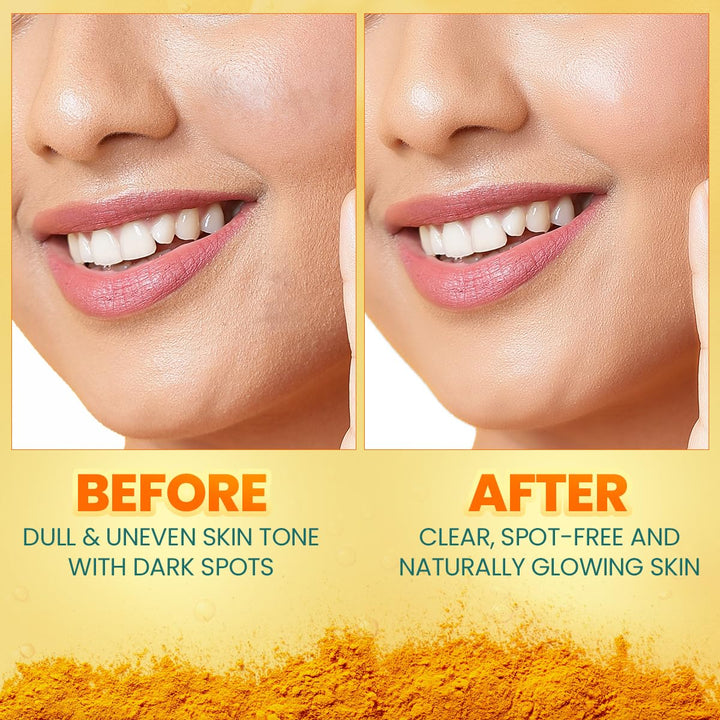 Himalaya - Dark Spot Clearing Turmeric Face Serum 30ml