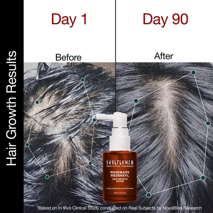 SoulFlower - Rosemary Redensyl Hair Growth Serum with Rosemary 1% Redensyl 3% Anagain 4% and Melanogray 1% 30ml