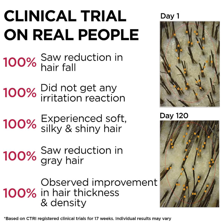 SoulFlower - Rosemary Redensyl Hair Growth Serum with Rosemary 1% Redensyl 3% Anagain 4% and Melanogray 1% 30ml