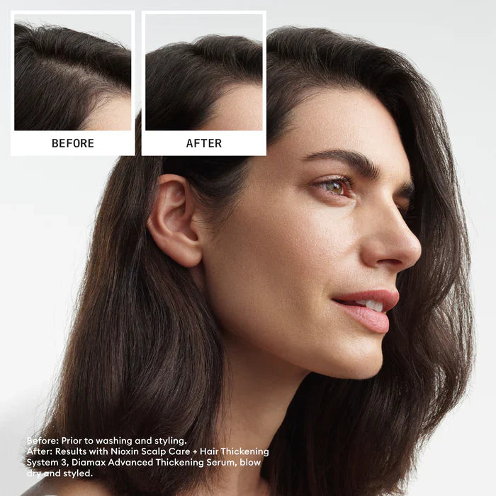 Nioxin Scalp + Hair Thickening System 3 Full Size Kit