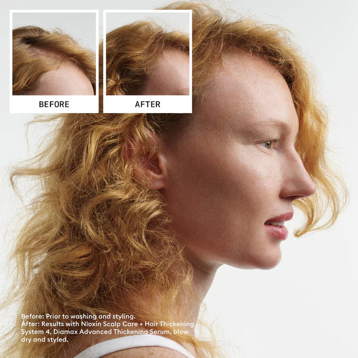 Nioxin Scalp + Hair Thickening System 4 Full Size Kit